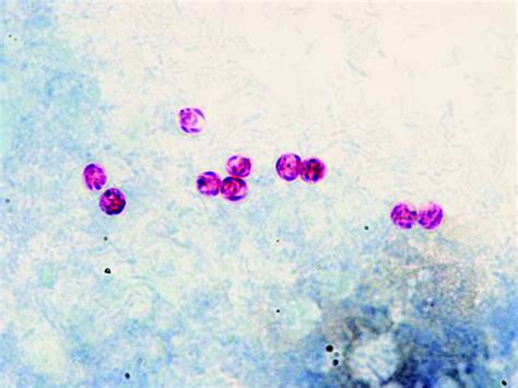  Kryptosporidium: Een microscopische parasiet die je darmflora flink kan op de proef stellen!