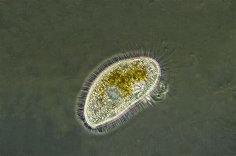  Cortina: Een enigmatische Ciliate met een voorkeur voor de bodem van zoetwatervijvers!