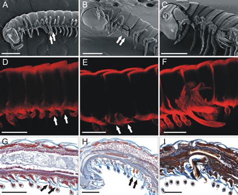  Juliform Millipede: A Tiny Armored Treasure Trove That Roams Underfoot!