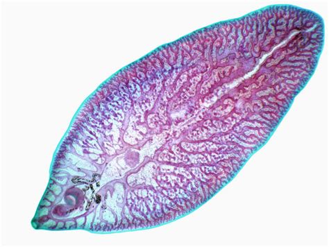  Liver Fluke: A Microscopic Mastermind Living Out Its Dramatic Existence Within Mammalian Bile Ducts!